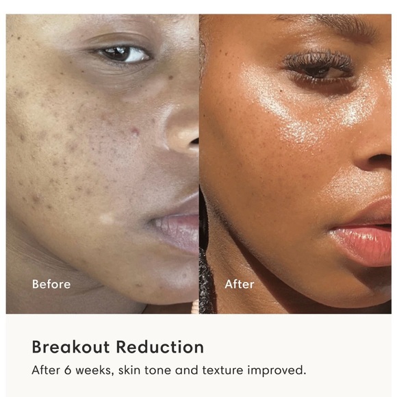 Boost LED Face Mask - Picture 11 of 12